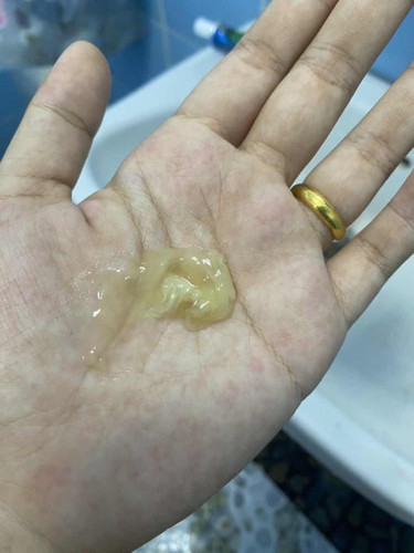 39+2w มีมูกแบบนี้ไหลออกมาค่ะ