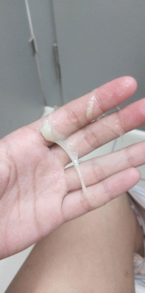 ตกขาวหรือมูกใส นานมั้ยกว่าจะคลอด