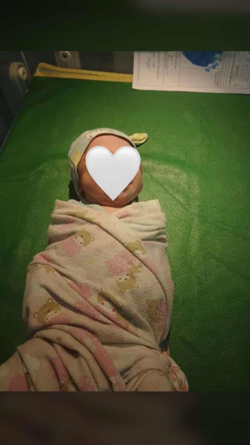 lahiran dengan induksi