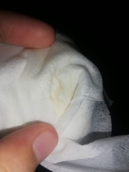 Sino po nag ka discharge kapag nag heragest thru vaginal?
Mnsn kz cream type sya