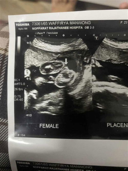 น้องเพศหญิงหรือชายคะ