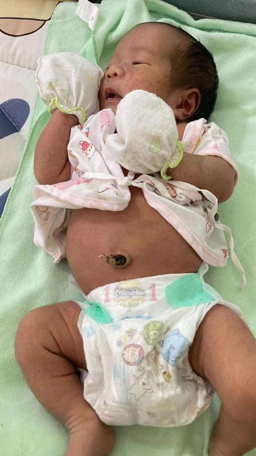 ลูกท้องป่อง เบ่งถ่ายไม่ออกเบ่งร้องหน้าแดง น้อง 14 วัน ขอวิธีช่วยดูแลลูกหน่อยค่ะ