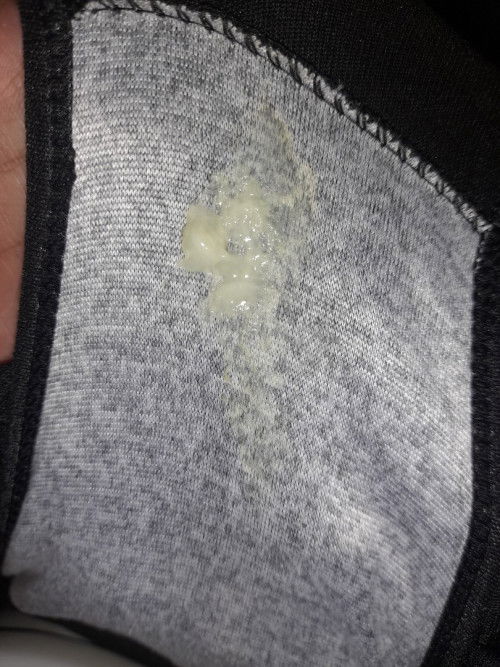 ตกขาวขณะตั้งครรภ์