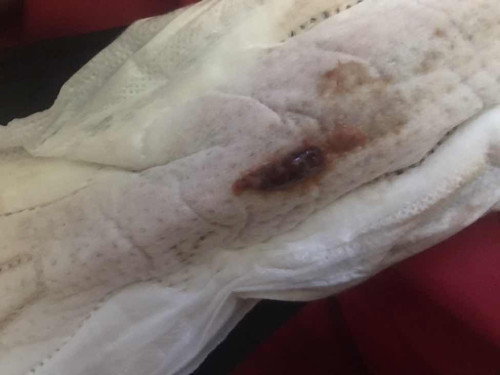 ขอถามเเม่ๆหลังคลอดหน่อยค่ะ