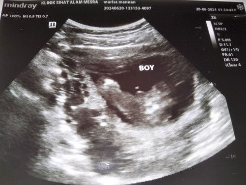 Tumpang tnya klau nmpak bgini confirm boy kah