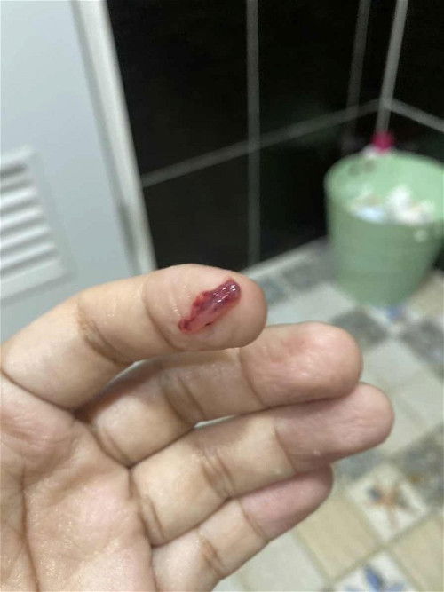 ถามแม่ๆหน่อยค่ะแบบนี้ปกติมั้ยคะ