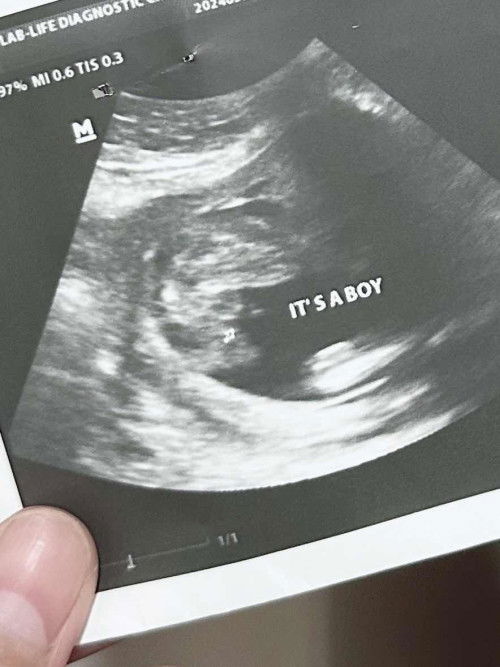 Sure baby boy napo kaya to mga mi?