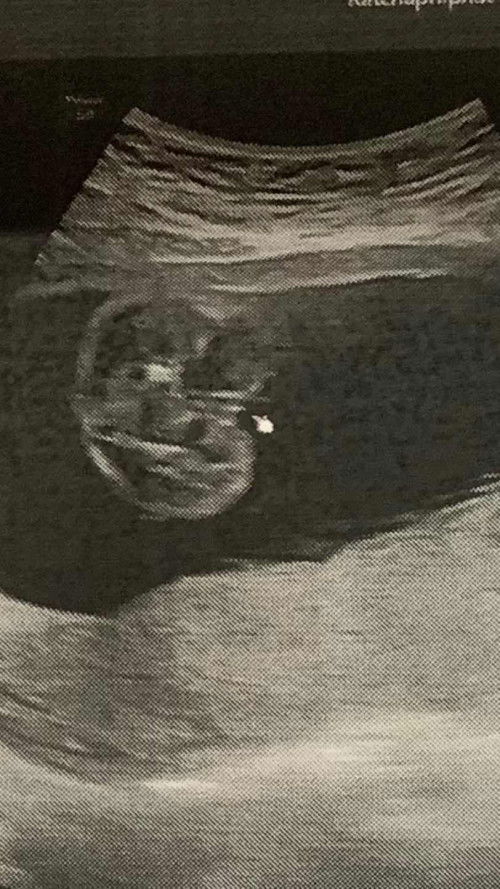 แม่ๆคนไหนรู้มั้ยคะ อันนี้เพศอะไร