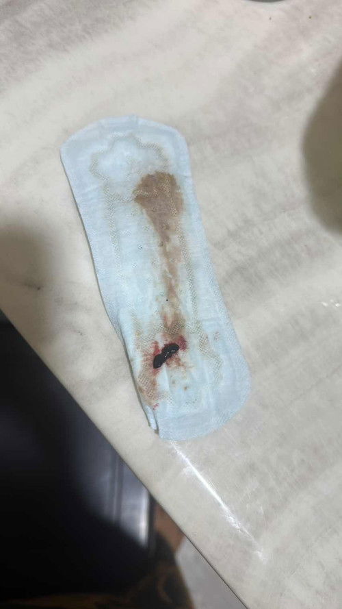 Tanda coklat & darah