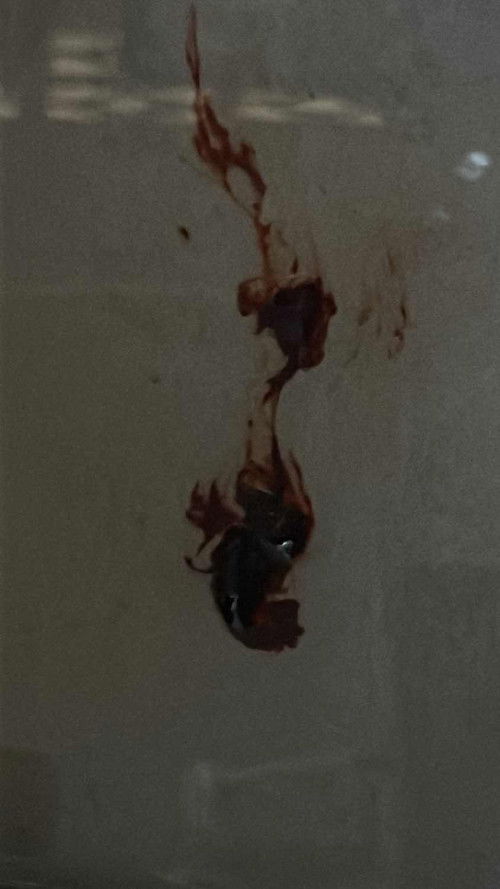 tengah melayan perut, mngdung 8week tp scan 5week, suspect kndungan tak mnjadi