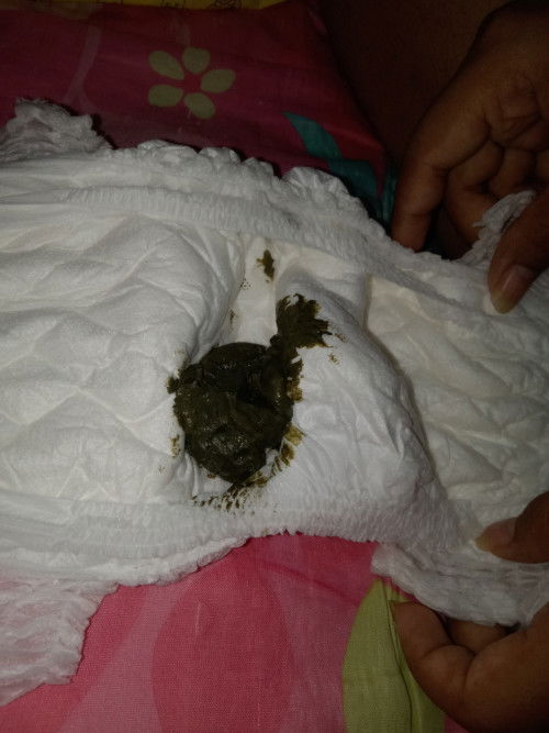 ขอสอบถามหน่อยค่ะหลานอึเป็นสีนี้ปกติมั้ยคะ