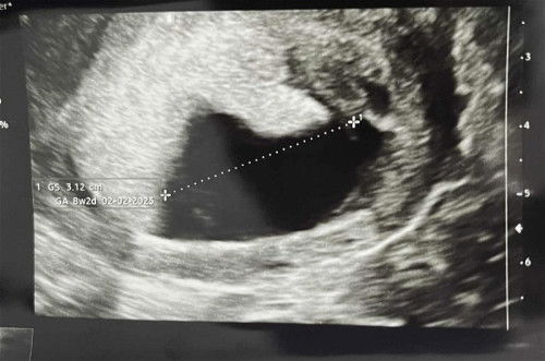 9 minggu suruh kembali 2 minggu lagi takut hamil BO