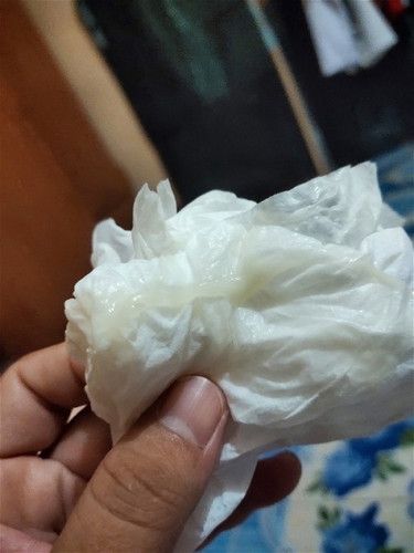 เเบบนี้ตกขาวหรือมูกใกล้คลอดค่ะ