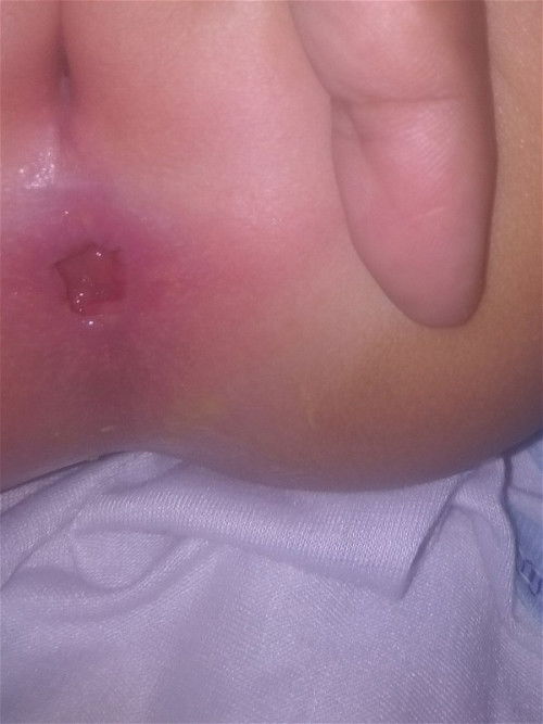 Bayi 6 bulan 25 hari nangis klo pup
Maaf siapa tau ada yg sma bayi nya seperti ini,,