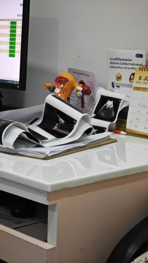 MFM สำคัญมาก