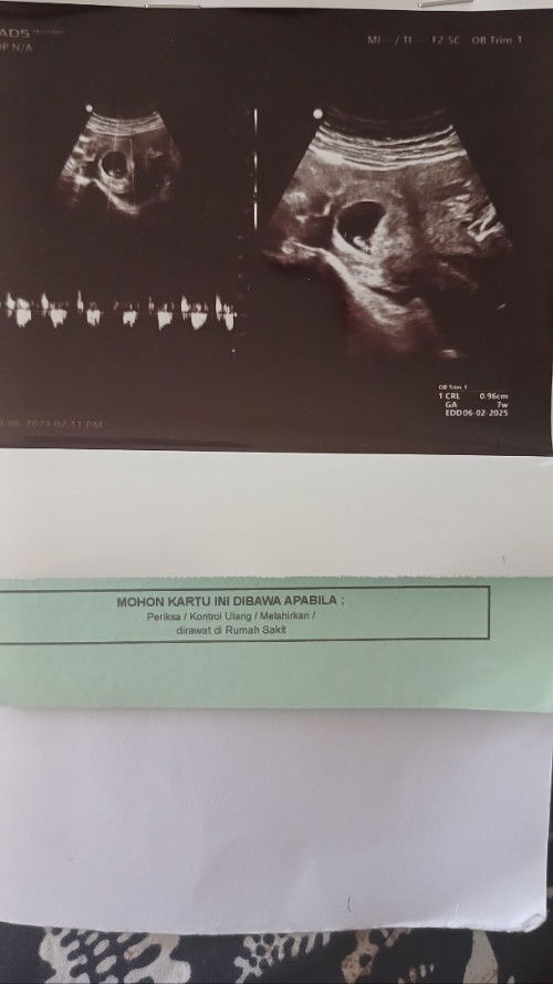 Djj tidak terdeteksi