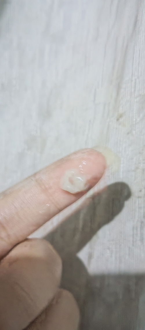 Pasintabi Po normal lng Po Kya gantong discharge buntis Po Ako 3 month