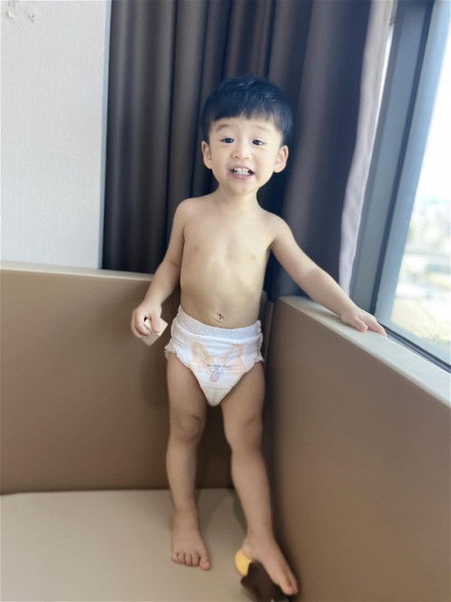 ตอนนี้ลองเปลี่ยนผ้าอ้อมตามคำแนะนำแล้ว โอเคมาก น้องต้นขาหายแดงแล้วค่ะ❤️