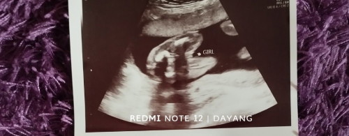 scan gender