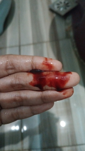 Ada yg pernah pendarahan kaya gini tapi baik2 aja nggak? Ini lagi mau ke dokter semoga baik2 aja.