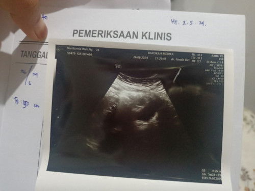 masih ada kah Mukzizat buat saya???