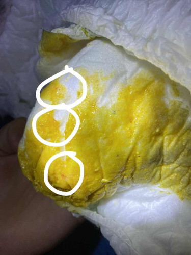 4เดือน11วันช่วยดูหน่อยค่ะแม่ๆแม่เครียดมากแม่มือใหม่