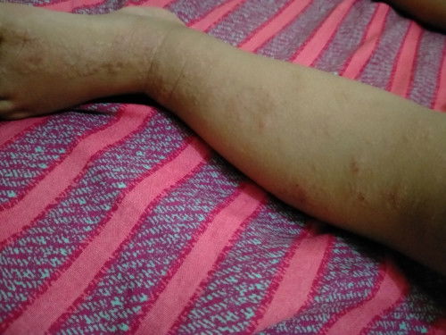 bngung nh biang keringet atau bukan