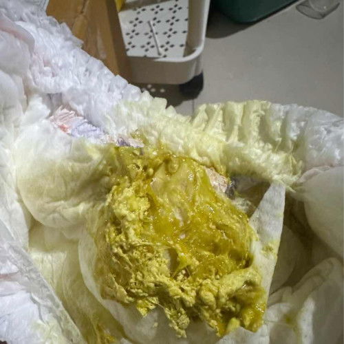 น้องถ่ายแบบนี้ปกติไหมคะ