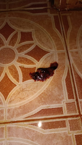 darah ngalir seperti haid disertai nyeri haid