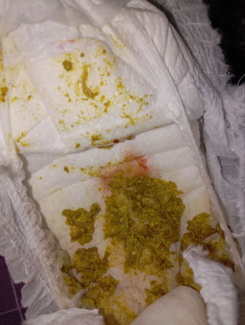 Bayi 9 bulan bab ada lendir merah muda