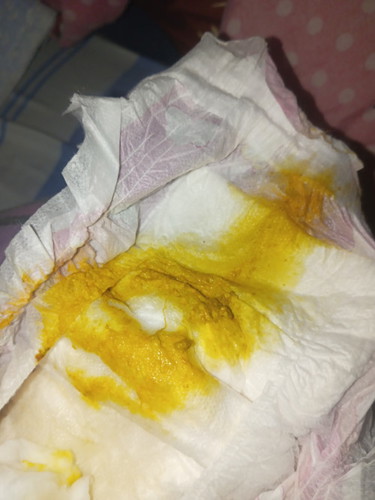 Poppy,hiyang po ba sya o hindi?