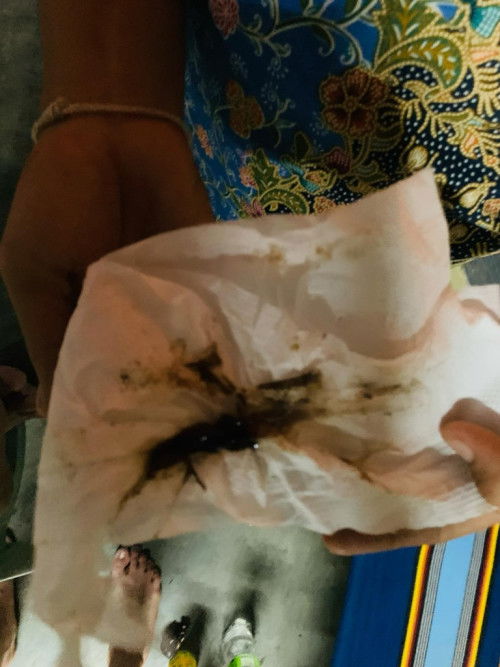 มีมูกเเบบนี้ไปหาหมอไหมค่ะ