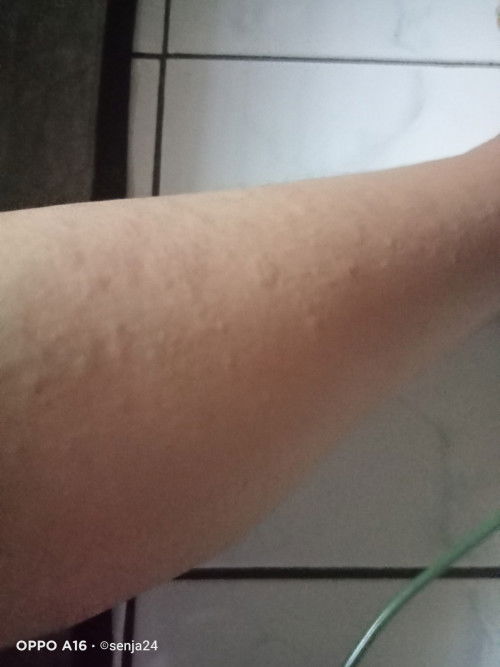 Gatal di usia kehamilan 8bln