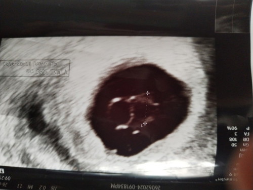 Scan saya