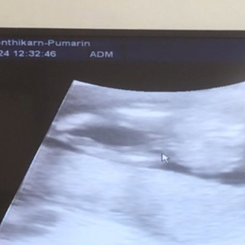 แม่ๆช่วยดฟุหน่อยค่ะ