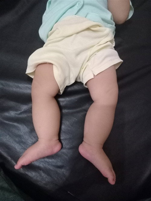 Model kaki bayi