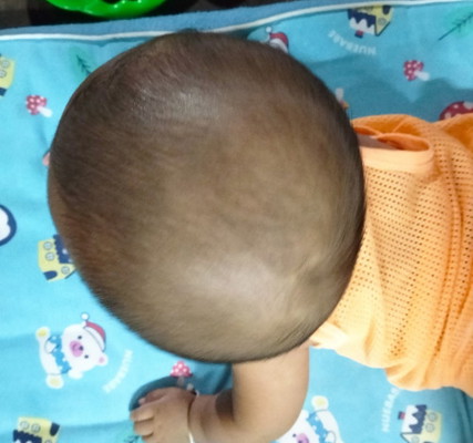 ลูกหัวเบี้ยว