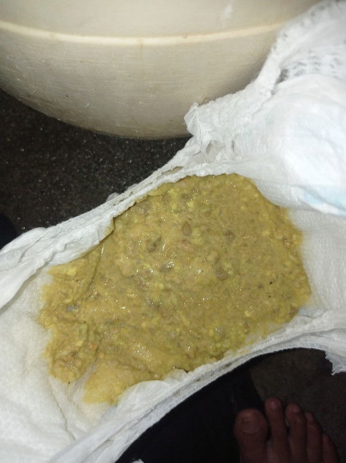 KULAY DILAW NA DUMI AND MAY SOMETHING.  Normal lang po ba, since nag ngingipin po ang baby ko?