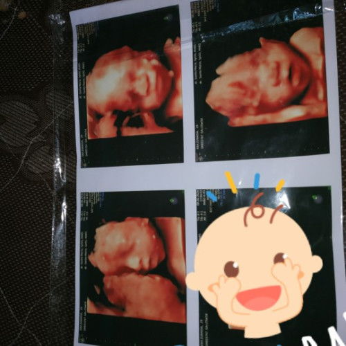 Sharing dong Bun, klo udah TM 3 baik ya USG yg 2d/4d ya ,, baik ya brpa kali menjelang lahiran ??