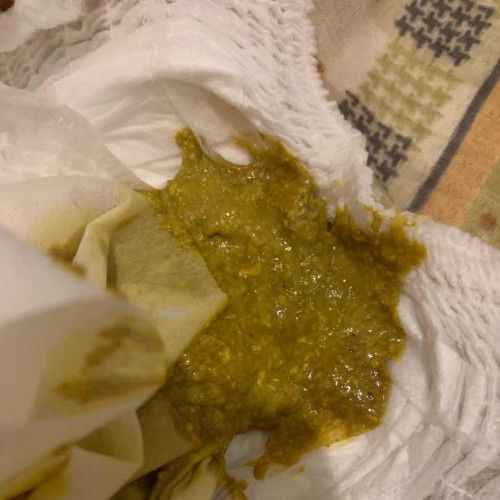 Poop cair bayi 7 bulan