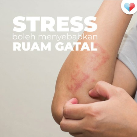Stress Boleh Menyebabkan Ruam Gatal!