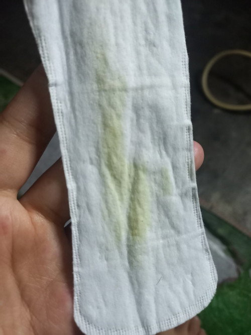 Ada yang tau ga obat keputihan gatal seperti keju trus kondisi lagi hamil