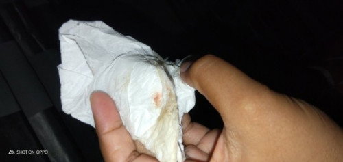 Darah Implantasi atau darah haid