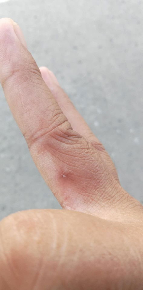 Nakalmot po ako ng pusa