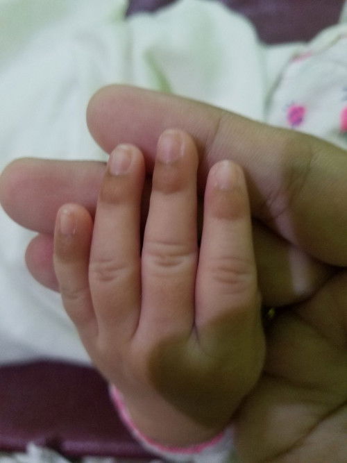 Ujung jari bayi warna coklat