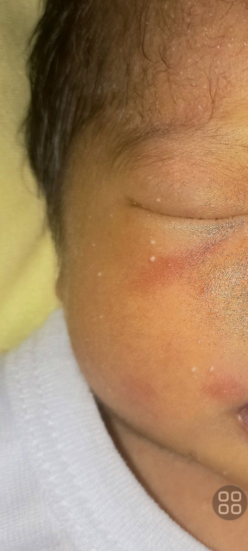 Masalah kulit bayi