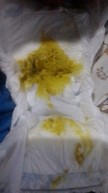 ขับถ่ายแบบนี้ ท้องเสีย หรือ ขับถ่ายปกติ