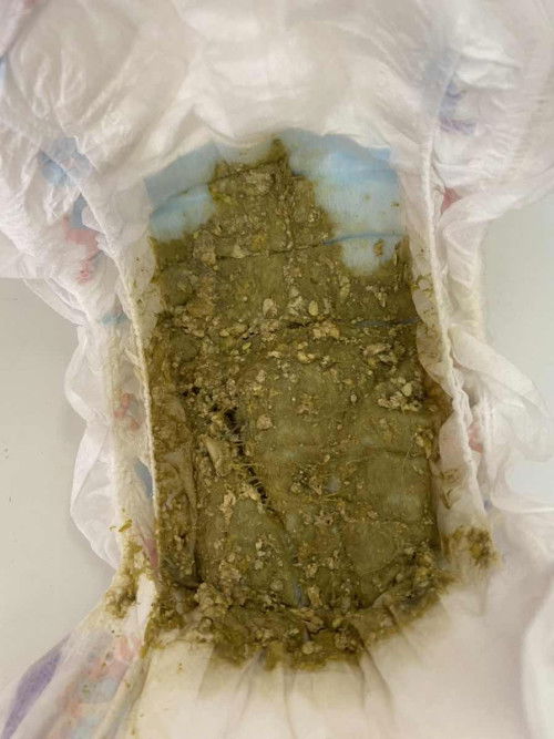 ANAK TAK SIHAT DAN BERAK BAYI