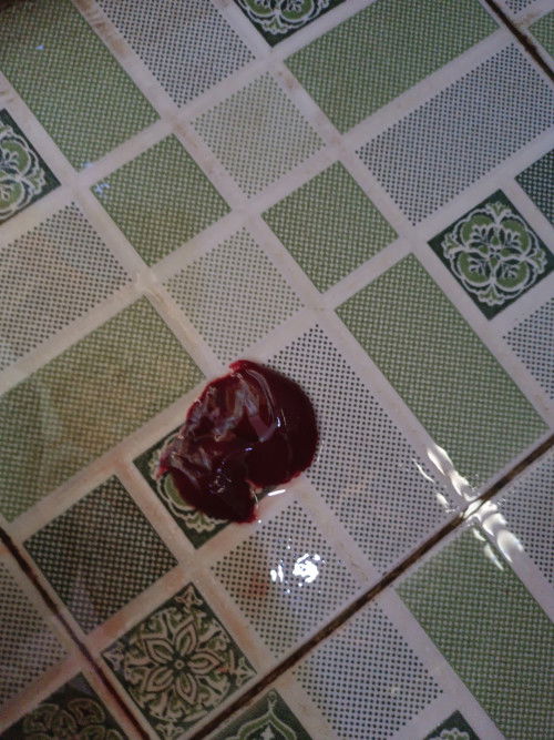 Keluar darah minggu ke 35