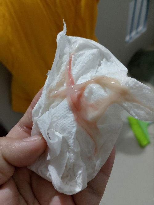 กระตุ้นปากมดลูก